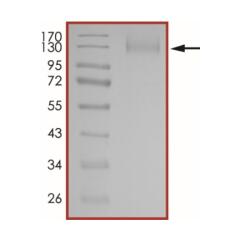 The purity of nCoV-S1 (A222V) was determined to be >90% by densitometry